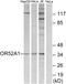 Olfactory Receptor Family 52 Subfamily A Member 1 antibody, GTX87382, GeneTex, Western Blot image 