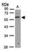 UDP-GlcNAc:betaGal beta-1,3-N-acetylglucosaminyltransferase 3 antibody, NBP1-32539, Novus Biologicals, Western Blot image 