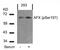 Forkhead Box O4 antibody, 79-168, ProSci, Western Blot image 