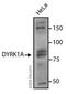 Dual Specificity Tyrosine Phosphorylation Regulated Kinase 1A antibody, ab69811, Abcam, Western Blot image 