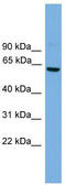 Protein CBFA2T2 antibody, TA329599, Origene, Western Blot image 
