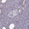Lumican antibody, HPA001522, Atlas Antibodies, Immunohistochemistry paraffin image 