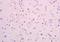 POZ-, AT hook-, and zinc finger-containing protein 1 antibody, orb100111, Biorbyt, Immunohistochemistry paraffin image 