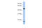 PLAG1 Like Zinc Finger 1 antibody, AVARP00029_P050, Aviva Systems Biology, Western Blot image 