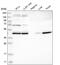 Kelch Repeat And BTB Domain Containing 2 antibody, PA5-54331, Invitrogen Antibodies, Western Blot image 