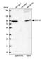 DEAD-Box Helicase 18 antibody, NBP2-58939, Novus Biologicals, Western Blot image 