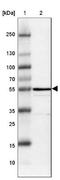 Ectonucleoside Triphosphate Diphosphohydrolase 5 (Inactive) antibody, NBP1-85751, Novus Biologicals, Western Blot image 