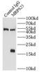 Mitochondrial Ribosomal Protein S25 antibody, FNab05356, FineTest, Immunoprecipitation image 