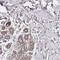 BCL9 Like antibody, NBP2-14350, Novus Biologicals, Immunohistochemistry frozen image 