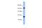 Uncharacterized protein FLJ37543 antibody, PA5-44396, Invitrogen Antibodies, Western Blot image 