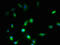 Synaptoporin antibody, A61222-100, Epigentek, Immunofluorescence image 