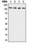 ADAM Metallopeptidase With Thrombospondin Type 1 Motif 2 antibody, GTX54941, GeneTex, Western Blot image 