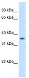 Aldo-Keto Reductase Family 1 Member B10 antibody, TA344167, Origene, Western Blot image 