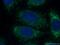 Interferon Beta 1 antibody, 27506-1-AP, Proteintech Group, Immunofluorescence image 