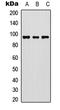 FER Tyrosine Kinase antibody, LS-C358982, Lifespan Biosciences, Western Blot image 