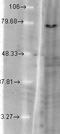Potassium voltage-gated channel subfamily KQT member 1 antibody, TA326344, Origene, Western Blot image 