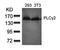 Phospholipase C Gamma 2 antibody, orb14578, Biorbyt, Western Blot image 