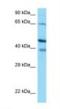 Calcium-binding protein 1 antibody, NBP1-98550, Novus Biologicals, Western Blot image 
