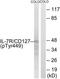 CD127 antibody, TA314073, Origene, Western Blot image 