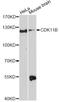 Cyclin-dependent kinase 11B antibody, LS-C747900, Lifespan Biosciences, Western Blot image 