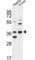Dehydrogenase/Reductase 3 antibody, abx034266, Abbexa, Western Blot image 