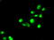 SATB Homeobox 1 antibody, TA500547, Origene, Immunofluorescence image 