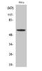 Monoamine Oxidase A antibody, STJ94000, St John