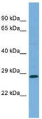 Mediator Complex Subunit 19 antibody, TA330946, Origene, Western Blot image 
