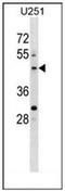 Pleckstrin Homology Domain Containing O2 antibody, AP53353PU-N, Origene, Western Blot image 