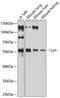 LYN Proto-Oncogene, Src Family Tyrosine Kinase antibody, 14-007, ProSci, Western Blot image 