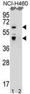 PRAME Family Member 22 antibody, AP53434PU-N, Origene, Western Blot image 