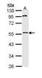 Membrane Palmitoylated Protein 1 antibody, GTX111779, GeneTex, Western Blot image 