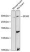E1A Binding Protein P300 antibody, 14-746, ProSci, Western Blot image 