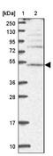 Proton-coupled amino acid transporter 2 antibody, NBP1-92401, Novus Biologicals, Western Blot image 