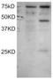 Dyslexia susceptibility 1 candidate gene 1 protein antibody, NBP1-68766, Novus Biologicals, Western Blot image 