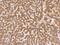 Copper chaperone for superoxide dismutase antibody, 208974-T08, Sino Biological, Immunohistochemistry frozen image 