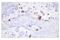 Keratin 5 antibody, 71536S, Cell Signaling Technology, Immunohistochemistry paraffin image 