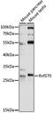 RING finger protein 170 antibody, LS-C750169, Lifespan Biosciences, Western Blot image 