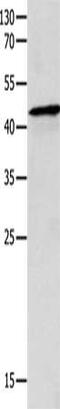 Melanocyte Inducing Transcription Factor antibody, CSB-PA173368, Cusabio, Western Blot image 