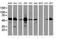 Epoxide Hydrolase 1 antibody, NBP2-45478, Novus Biologicals, Western Blot image 