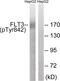 Fms Related Tyrosine Kinase 3 antibody, 79-845, ProSci, Western Blot image 