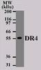 TNF Receptor Superfamily Member 10a antibody, TA336474, Origene, Western Blot image 