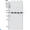 Histone Deacetylase 3 antibody, LS-C812634, Lifespan Biosciences, Western Blot image 