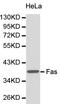 FAS antibody, LS-C192615, Lifespan Biosciences, Western Blot image 