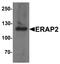 Endoplasmic reticulum aminopeptidase 2 antibody, A04269, Boster Biological Technology, Western Blot image 