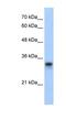 Ribosomal Protein L8 antibody, NBP1-57479, Novus Biologicals, Western Blot image 