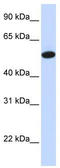Carcinoembryonic Antigen Related Cell Adhesion Molecule 16 antibody, TA336003, Origene, Western Blot image 