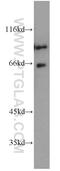 SATB Homeobox 2 antibody, 21307-1-AP, Proteintech Group, Western Blot image 