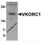 Vitamin K Epoxide Reductase Complex Subunit 1 antibody, 6795, ProSci Inc, Western Blot image 