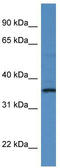 RIO Kinase 1 antibody, TA343004, Origene, Western Blot image 